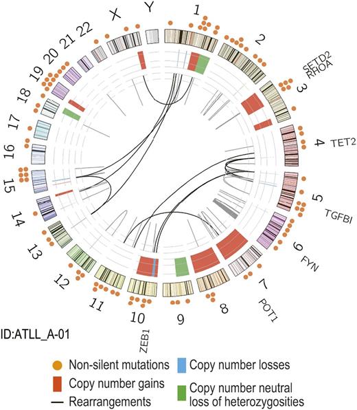 Figure 1. Identification of RHOA mutations in ATLL. Circos plot of genomic alterations obtained from WGS for a single ATLL case. Locations of somatic non-silent mutations (n = 96) are indicated (orange circles). Abnormalities in genomic copy number are shown in red for gains, blue for losses, and green for copy number neutral loss of heterozygosities. Chromosomal rearrangements are indicated in the inner circle (black lines).