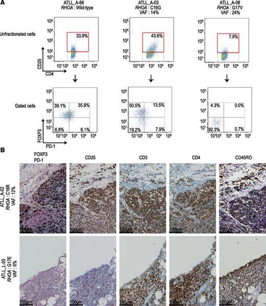 Figure 6. Analysis of cell surface and intracellular markers in RHOA-mutated cases. (A) Analysis of cell surface marker in RHOA mutated cases. Expression of PD-1 and FOXP3 (bottom) in the CD4+CD25+ tumor cell fraction (top) in primary ATLL samples. Results of 3 representative cases are shown. Case ID, type of RHOA mutations, and their VAFs are also indicated. Numbers in boxes show percentage of cells in the indicated fractions. (B) Immunohistochemical analysis of formalin-fixed paraffin-embedded specimens obtained from the lymph nodes of two RHOA-mutated ATLL cases. Representative images of double staining with FOXP3 (intra-nuclei, brown) and PD-1 (cytosol, blue), and single staining with CD25, CD3, CD4, and CD45RO (brown) are shown.