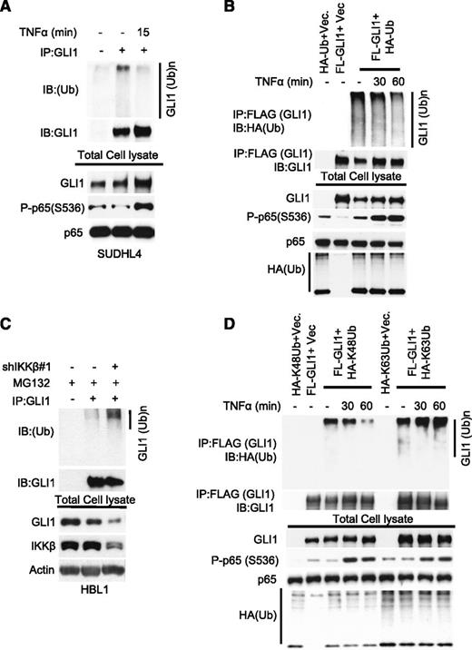 Figure 3. TNFα-mediated activation of IKKβ suppresses GLI1 ubiquitination. (A) Immunoprecipitation analysis of ubiquitinated-GLI1 in SUDHL4 cells stimulated with or without TNFα (20 μg/mL) for 15 minutes. (B) Indicated constructs were coexpressed in 293T cells. Before cell lysis, cells were stimulated with or without TNFα for indicated time periods. Total cell lysates were subjected to anti-GLI1 immunoprecipitation. Bound ubiquitinated-GLI1 was detected by anti-HA antibody. (C) Immunoprecipitation analysis of total ubiquitinated-GLI1 in control (Cont.) or partially IKKβ-depleted HBL1 cells after treated with proteasome inhibitor MG132 (10 μg/mL) for 6 hours. (D) Immunoprecipitation analysis of K48 or K63-linked ubiquitinated-GLI1 in 293T cells transfected with FL-GLI1 and HA-K48 or HA-K63–linked ubiquitin constructs. Before cell lysis, cells were stimulated with or without TNFα (20 μg/mL) for indicated time periods.