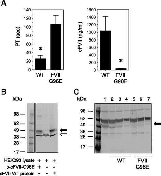 Figure 1. Dogs with FVII-G96E mutation show reduced prothrombin time (PT) and minimal cFVII antigen by ELISA and western blot. (A) Using a PT clotting assay, hemostatically normal dogs (n = 5, WT) exhibited a clot time of 26 ± 7.2 seconds. In contrast, FVII-G96E dogs (n = 4) had a clot time of 106.4 ± 20 seconds (P < .05), corresponding to <1% cFVII activity. An ELISA was developed to detect cFVII antigen in canine plasma. Hemostatically normal dogs (n = 5, WT) were found to express 1040 ± 380 ng/mL, in contrast to FVII-G96E dogs (n = 4) that expressed ∼40 ng/mL. (B) Detection of cFVII-G96E or cFVII-WT in cell lysates by fluorescence-based western blot (shown in gray scale). HEK 293 cells were transiently transfected with a plasmid expressing cFVII-G96E (p-cFVII-G96E17). Untransfected control cell lysates without or with added recombinant cFVII-WT protein (1 µg) are shown. Black arrow indicates cFVII-WT or FVII-G96E. White arrow indicates the β-actin loading control. (C) Detection of endogenous canine WT FVII or FVII-G96E in canine plasma by fluorescence-based western blot (shown in gray scale). Lane 1, FVII-G96E plasma with 1 µg of recombinant cFVII-WT added (final sample diluted 1:16 in PBS); lanes 2 to 4, normal canine plasma diluted 1:16, 1:32, and 1:64 in PBS (respectively); lanes 5 to 7, FVII-G96E plasma diluted 1:16, 1:32, and 1:64 in PBS (respectively). Black arrow indicates canine WT FVII or FVII-G96E.