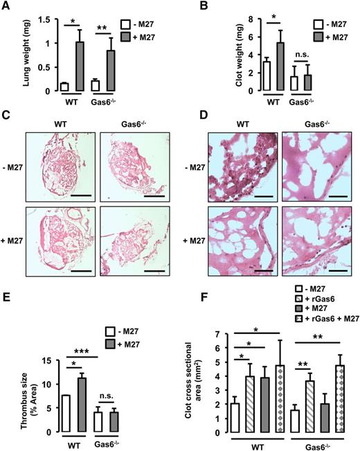 Figure 1. Gas6 deficiency protects mice against lung cancer-induced venous thrombosis. (A) WT and Gas6−/− mice were injected with M27 cancer cells. After 14 days for the WT mice and 17 to 21 days for the Gas6−/− mice, lung weight was measured to ascertain similar tumor burden. Lung weight was increased equivalently in WT and Gas6−/− mice. WT mice injected with M27 cancer cells developed significantly larger thrombi compared with WT mice injected with phosphate-buffered saline. Gas6−/− mice did not develop larger thrombi as seen by (B) clot weight, (C) H&E staining of thrombus sections (bars, 100 μm), and (D) higher magnification of H&E staining (bar, 10 μm). (E) Quantifications of the H&E staining expressed as thrombus size. (F) Cross-sectional area measured by ultrasonography confirmed that lung cancer increased venous thrombosis in WT but not Gas6−/− mice. Injection of rGas6 restored the WT phenotype in Gas6−/− mice. *P < .05 comparing WT vs WT + M27, WT vs WT + rGas6, and WT vs WT + rGas6 + M27; **P < .05 comparing Gas6−/− vs Gas6−/− + rGas6, Gas6−/− vs Gas6−/− + M27, and Gas6−/− vs Gas6−/− + rGas6 + M27; ***P < .05 comparing WT vs Gas6−/−. n.s., not significant.