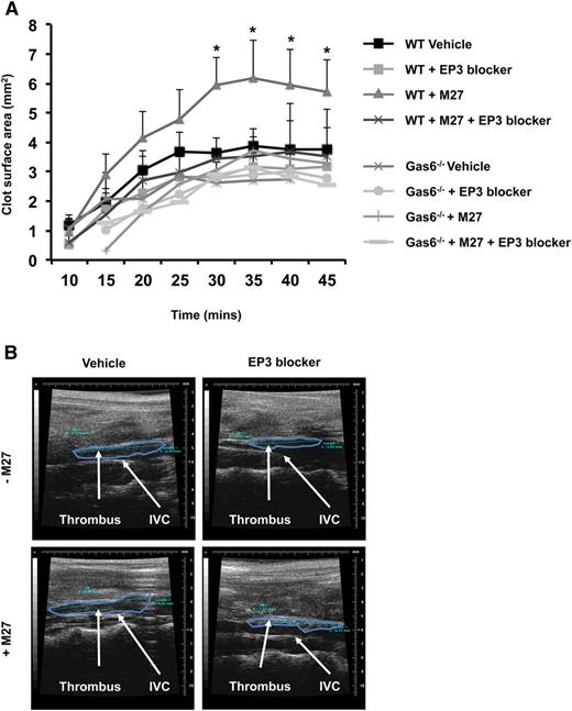 Figure 7. Blocking EP3 receptors reduced cancer-induced venous thrombosis in WT mice. (A) Administering EP3 blocker to WT mice with cancer prior to induction of venous thrombosis, protects these mice from cancer-induced venous thrombosis as demonstrable by ultrasonography. (B) Representative pictures of venous thrombi in the 4 experimental groups obtained by HFUS. *P < .05 WT + M27 vs WT + M27 + EP3 blocker.