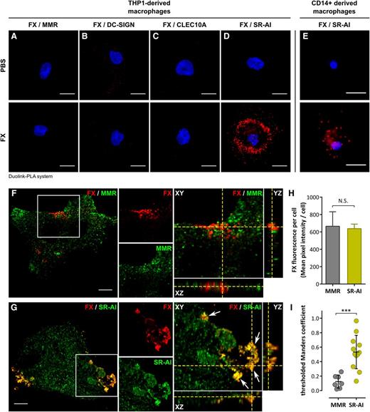 Figure 2. Colocalization of FX in human macrophages. (A-E) Widefield microscopy images of Duolink-PLA assay between FX and MMR (A), DC-SIGN (B), CLEC10A (C), or SR-AI (D) in THP1-derived macrophages, or between FX and SR-AI in CD14+-derived macrophages (E) incubated with either PBS (top panels) or FX (bottom panels). Nuclei were counterstained using DAPI. Bars represent 10 µm; objective, ×40. Red spots indicate a distance <40 nm between 2 antigens. Images are representative of 3 different experiments. (F-I) Confocal analysis of immunofluorescent staining for FX (red) and MMR (F) or SR-AI (G) in a THP1-derived macrophage incubated with FX. Cell stack was reconstituted in orthoview to visualize colocalization of the 2 signals (right panels). Arrows indicate areas of colocalization. Z depth is 0.5 µm; bars represent 10 µm; objective, ×63. The mean FX fluorescence of the cells was quantified using Fiji software (H). tMC represents a statistical parameter verifying whether fluorescent signals truly overlap and was calculated using JACoP plugin in Fiji for THP1-derived macrophages incubated with FX and immunostained for FX and MMR (negative control) or SR-AI (I). ***P < .001, respectively, in the Mann-Whitney nonparametric unpaired statistical test. Dots represent each individual cell value and bars represent the mean ± SD of 7 (FX/MMR) to 12 (FX/SR-AI) cells from 3 independent experiments. PBS, phosphate-buffered saline.
