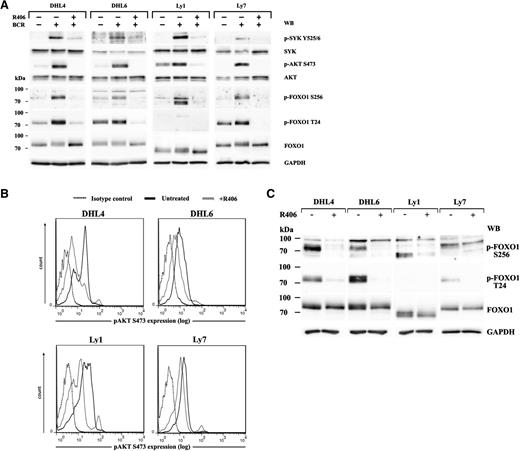 Figure 1. The BCR-SYK-AKT-FOXO1 signaling pathway is operative in tonic BCR signal-dependent DLBCL cell lines and leads to the suppression of FOXO1 activity. (A) The integrity of the BCR-SYK-AKT-FOXO1 axis was determined in BCR-dependent cell lines DHL4, DHL6, Ly1, and Ly7 after crosslinking of their BCRs, with or without R406 pretreatment. Activity of key signaling components of the pathway was assessed with phospho-specific antibodies against SYK(Y525/6), AKT(S473), and FOXO1(T24 and S256). Blots were next stripped and reprobed with antibodies against total-SYK, total-AKT, and total-FOXO1. GAPDH served as a loading control. Densitometric quantification of band intensities is provided in supplemental Table 4. (B) DLBCL cells were treated with R406 (gray line) or vehicle alone (black line) for 18 hours and subjected to single-cell phospho-flow analysis to detect tonic AKT phosphorylation at S473. Dotted line, isotype control. (C) FOXO1 phosphorylation in DLBCL cell lines treated for 18 hours with R406 or vehicle alone was analyzed by immunoblotting. Densitometric quantification of band intensities is provided in supplemental Table 5.