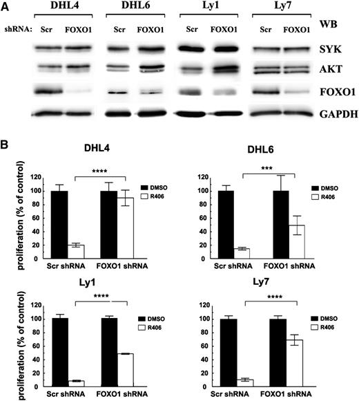 Figure 3. FOXO1 mediates toxicity of SYK inhibitor in tonic BCR signal-dependent DLBCL cells. DHL4, DHL6, Ly1, and Ly7 cells were transduced with pSiren-RetroQ-scrambled-shRNA (Scr shRNA) or pSiren-RetroQ-FOXO1-shRNA (FOXO1 shRNA), and stable transfectants were selected using puromycin. (A) FOXO1, AKT, and SYK protein expression was analyzed by immunoblotting. GAPDH served as a loading control. Densitometric quantification of band intensities is provided in supplemental Table 7. (B) Cells transduced with FOXO1-targeting shRNA vectors were treated with R406 and after 72 hours were analyzed for proliferation using the MTS assay. Please also see supplemental Figure 3 for additional information.
