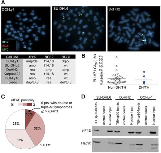 Figure 1. eIF4E is expressed in DH/TH DLBCL. (A) Representative image of BCL2, BCL6, and MYC FISH assay carried out in OCI-Ly1, SU-DHL6, and DoHH2 cell lines. Summary of FISH findings for MYC, BCL2, and/or BCL6 in 6 DLBCL cell lines harboring >1 of such chromosomal abnormalities. (B) Scatter plot for PU-H71 GI50 (growth inhibitory concentration 50%) in DH/TH cell lines (n = 6) vs non-DH/TH DLBCL cell lines (n = 29). (C) eIF4E expression by immunohistochemistry from 111 DLBCL cases. Number of positive cells (over total cells) is represented by color scale. All the DH/TH cases in the cohort (n = 6) presented the highest levels of eIF4E staining (n = 10). (D) Affinity purification of eIF4E and TEHsp90 from DH/TH cell lines nuclear lysates using PU-H71-beads vs chemical control beads.