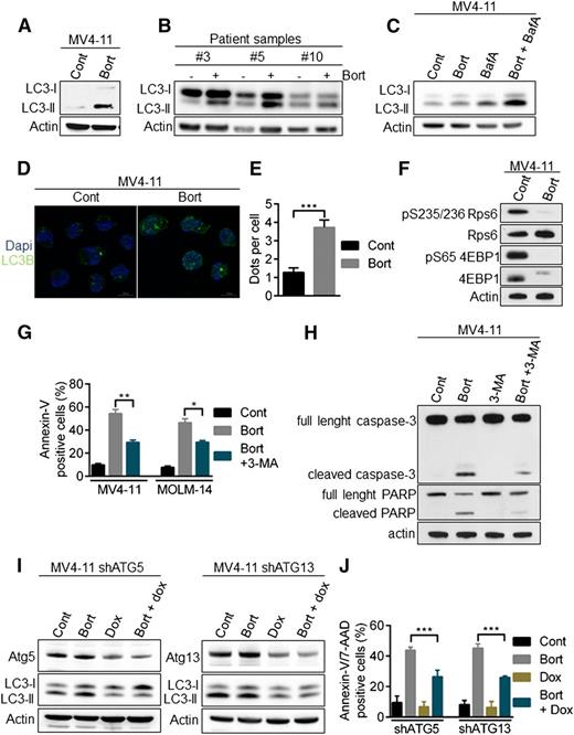 Figure 3. Activation of autophagy by bortezomib in AML cells. (A-B) LC3-II accumulation after bortezomib (Bort) exposure. MV4-11 or primary AML samples were treated 24 hours with 10 or 30 nM bortezomib, respectively. Total cell lysates were resolved by sodium dodecyl sulfate (SDS)-polyacrylamide gel electrophoresis (PAGE) and immunoblotted with the indicated antibodies. (C) Bortezomib induces an active autophagic flux. MV4-11 cells were incubated 24 hours with 10 nM bortezomib alone or in combination with 10 nM Bafilomycin A for the last 2 hours. Cells were lysed and LC3-I to LC3-II conversion was assessed by western blot analysis using the appropriate antibodies. (D) Immunofluorescence staining of LC3 positive structures. MV4-11 cells were exposed 24 hours with 10 nM bortezomib before immunofluorescence analysis using LC3-B antibody and an antimouse-Alexa 488 antibody, and labeling with 4,6 diamidino-2-phenylindole. Analyses were performed on a Zeiss Apotome microscope. (E) Quantification of LC3-positive dots. At least 100 cells per condition of 3 independent experiments were counted. (F) Inhibition of the mammalian target of rapamycin complex 1 pathway. MV4-11 cells were incubated 12 hours with 10 nM bortezomib before cell lysis and western blot analysis. (G-J) Bortezomib induces a cytotoxic autophagy. (G) MV4-11 or MOLM-14 cells were treated 24 hours with 10 nM bortezomib alone or in combination of 5 mM 3-MA before Annexin-V/7-AAD staining and flow cytometry analysis. (H) MV4-11 cells were incubated 24 hours with bortezomib and/or 5 mM 3-MA before immunoblotting analysis using the appropriate antibodies. (I-J) MV4-11 cells were infected with TRIPZ lentiviral shRNA targeting ATG5 or ATG13 and transduced cells were selected by 1 µg/mL puromycin. First, shRNA were induced by 72 hours 1 µg/mL doxycycline treatment and then next the cells were incubated for 24 hours in the presence of 10 nM bortezomib. (I) Total cell lysates were resolved by SDS-PAGE and immunoblotted with the indicated antibodies (J) Apoptosis was evaluated after Annexin-V/7-AAD labeling via flow cytometry. *P < .05; **P < .01; ***P < .001.