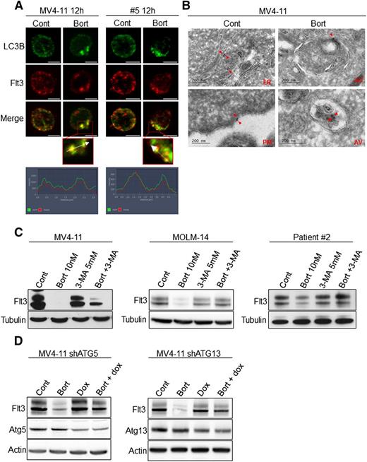 Figure 4. Bortezomib induces FLT3-ITD degradation through autophagy in leukemic cells. (A) Colocalization of FLT3-ITD and LC3-positive structures. MV4-11 cells were treated 12 hours with 10 nM bortezomib (Bort) before immunofluorescence analysis using LC3-B, FLT3, anti-mouse-Alexa 488, anti-rabbit A594 antibodies, and labeling with 4,6 diamidino-2-phenylindole. FLT3-ITD primary AML sample #8 was treated 12 hours with 30 nM bortezomib and analyzed by immunofluorescence with LC3-B and FLT3 antibodies. Analyses were performed on a Zeiss Apotome microscope. (B) Detection of FLT3-ITD in autophagosomes. MV4-11 cells were treated 12 hours with 10 nM bortezomib, fixed, and analyzed by electron microscopy using the Tokuyasu method. FLT3-ITD was labeled using an anti-FLT3 antibody and a secondary antibody coupled to gold beads. Observations were realized on a JEOL JEL-1400 transmission electron microscope. (C-D) Autophagy inhibition rescues FLT3-ITD protein expression. (C) MV4-11, MOLM-14, or patient sample #2 were treated 24 hours with 10 nM or 30 nM bortezomib before cell lysis and immunoblotting analysis using indicated antibodies. (D) Atg5 or Atg13 shRNA were induced by 72 hours treatment with 1 µg/mL doxycycline. Cells were then incubated 24 hours with 10 nM bortezomib and total cell lysates were analyzed by western blot.