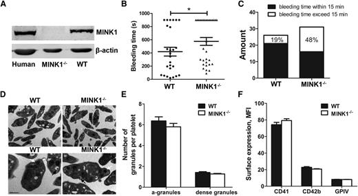 Figure 1. MINK1−/− mice display features of unstable hemostasis in vivo. (A) Analysis of MINK1 expression in platelets from human, WT, and MINK1−/− mice. (B) Bleeding times for WT (●) and MINK1−/− mice (▲). Means are indicated by horizontal lines. Statistical significance was evaluated with 2-tailed Mann-Whitney U tests (*P < .05). (C) Percentages of WT and MINK1−/− mouse bleeding times exceeded 15 minutes (□) or were within 15 minutes (▪). Results were obtained from 26 WT and 31 MINK1−/− mice. (D) Electron microscopic images of WT and MINK1−/− platelet ultrastructure (black arrows, dense granules; white arrows, α-granules). Scale bars, 1 μm (top) and 0.5 μm (bottom). (E) Quantification of α-granules and dense granules of WT (▪) and MINK1−/− (□) platelets. Under ×24 000 magnification, α-granules and dense-granules in 160 platelets (80 from WT and MINK1−/− each) were counted. The data were expressed as mean ± SEM. Statistical significance was evaluated with the Student t test. (F) Surface expression of CD41, CD42b, and GPVI, as determined by flow cytometry with FITC-conjugated anti-mouse CD41 mAb (MWReg30), FITC-conjugated anti-mouse CD42b mAb (Xia.B2), and FITC-conjugated anti-mouse GPVI mAb (JAQ1). Results are expressed as mean fluorescence intensity (MFI), and are the mean ± SEM. Statistical significance was evaluated with the Student t test.
