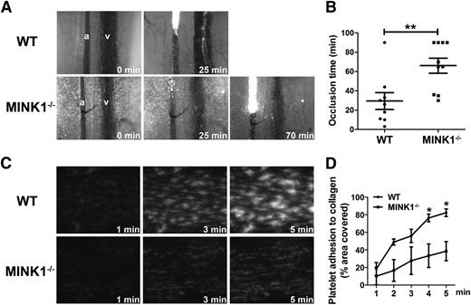 Figure 2. MINK1−/− mice display impaired thrombus formation in vitro and in vivo. (A) Representative images and time courses of thrombus formation induced by FeCl3 injury to mesenteric arterioles in WT (top row) and MINK1−/− mice (bottom row). a, arteriole; v, venule. (B) Dot plot showing occlusion times for arterioles as a result of FeCl3-induced thrombosis in WT (n = 9) and MINK1−/− mice (n = 10). Means are indicated by horizontal lines. **P < .01, 2-tailed Mann-Whitney test. (C) Photomicrographs showing the progression of adhesion of platelets from WT and MINK1−/− mice on collagen. Whole blood from WT and MINK1−/− mice, collected in heparin (7.5 U/mL), was fluorescently labeled by incubation with mepacrine (100 μM) for 30 minutes, and then perfused through fibrillar collagen-coated bioflux plates at a shear rate of 40 dynes/cm2 for 5 minutes. Original magnification, ×20. (D) Dot plot showing area coverage of platelets from WT and MINK1−/− mice (n = 3 for each group; *P < .05, Student t test).