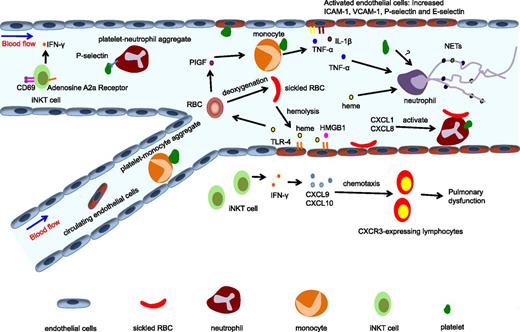 Figure 2. Inflammation in SCD. SCD has been recognized as a chronic inflammatory disease. Multiple cell types and molecules are involved in its inflammatory pathways. Hemolysis of RBCs leads to the release of heme into the circulation, which can activate endothelial cells through the TLR4 pathway and induce PlGF release from RBCs. PlGF activates monocytes, leading to the production of proinflammatory cytokines TNF-α and IL-1β. The adhesion of platelets or sickle RBCs can also activate endothelial cells, producing increased expression of adhesion molecules including ICAM-1, VCAM-1, P-selectin, and E-selectin, and thus promoting the recruitment of neutrophils. iNKT cells exhibit an activated phenotype and contribute to pulmonary dysfunction in SCD by producing IFN-γ and inducing CXCR3 chemokines. Platelets can form aggregates with circulating leukocytes, including neutrophils and monocytes. Activated neutrophils roll and adhere to the endothelium, and initiate VOC by capturing sickle RBCs. Heme can also induce NET formation, which promotes acute pulmonary injury in SCD. HMGB1, high mobility group box 1; iNKT cell, invariant natural killer T cell.