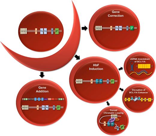 Figure 2. Strategies for gene therapy for SCD: schematic overview of various approaches for correcting the sickle phenotype via gene therapy. Gene correction: targeted genome engineering leads to correction of the sickle mutation such that βS is repaired as βA. HbF induction: multiple strategies for induction of γ-globin expression include shRNA-mediated knockdown of BCL11A, targeted disruption of the +58 DNase I HS site in the BCL11A erythroid-specific enhancer, and forced chromatin looping to promote association of the β-globin LCR with the γ-globin genes. Gene addition: integrating lentiviral vector carrying a β-globin, γ-globin, or antisickling β-globin cassette. Ldb1, transcription factor; ZF/SA, zinc-finger self-association domain.