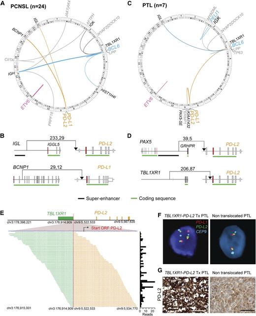 Figure 3. Chromosomal rearrangements in PCNSL and PTL. (A,C) Detected chromosomal rearrangements in 24 PCNSL (A) and 7 PTL (C) are summarized as circos plots. Structural alterations involving certain partners are highlighted; BCL6, blue; ETV6, pink; PD-1 ligands, orange. Partners of color-coded alterations are black, all other alterations are gray. Frequency of events is indicated by line thickness. (B,D) Chromosomal rearrangements involving PD-L1 or PD-L2 are plotted in their genomic context. Exons are visualized as boxes, ATG-containing exon are in red, the coding region is underlined in green, and previously identified super-enhancers in DLBCLs43 are underlined in black. The number of supporting reads (split reads, read pairs) is indicated above each translocation. (E) TBL1XR1-PD-L2 fusion as validated by RNA-Seq. Chromosomal breakpoint is depicted by the red line. Start codon of PD-L2 is indicated in red within the contig of the RNA-Seq reads. The translocation involves only the regulatory elements of TBL1XR1 and does not affect the open reading frame (ORF) of PD-L2. Individual supporting reads are shown in the lower panel, with frequencies as a bar graph on the right. (F) FISH assays of PTLs with the PD-L2 translocation (left panel) or with wild-type PD-L2 (right panel). PD-L1 in red, PD-L2 in green, and centromeric probe (CEP9) in aqua. (G) IHC of PD-L2 expression in the translocated PTL (left panel) and a PTL with wild-type PD-L2 (right panel). The scale bar represents 100 μm.