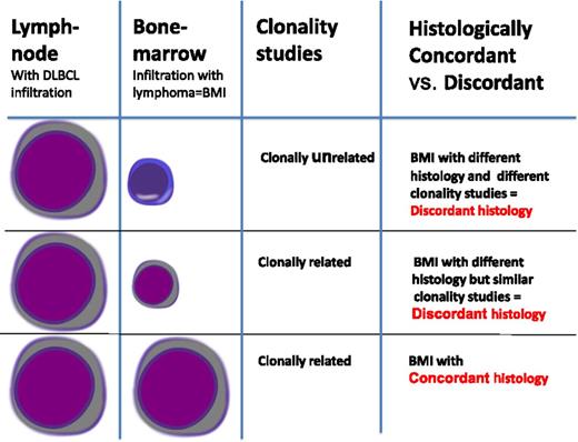 Figure 1. Discordant histology vs discordant clonality. For patients with DLBCL at a nodal site, lymphomatous BMI may be either histologically concordant large B-cell involvement or histologically discordant small B-cell involvement, which suggests an indolent BCL involving the BM. Histologically discordant BMI may be either clonally related or clonally unrelated to the nodal DLBCL with molecular analysis.