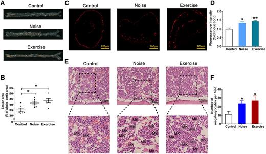 Figure 3. Long-term stress-induced thrombopoiesis contributes to the aggravation of atherosclerosis in ApoE−/− mice. (A) Representative aortas from ApoE−/− mice subjected to noise or exhaustive exercise stress for 8 weeks. (B) Quantification of the lesion size in the whole aorta. Each data point represents a value from a single mouse; n = 6. (C) Immunofluorescence staining of platelets with the CD41 antibody in the atherosclerotic lesions in the right carotid artery. (D) Quantification of fluorescence intensity of CD41 in the atherosclerotic lesions in the right carotid artery. (E) Distributions of MKs in the BM in the mice. (F) Quantification of MKs in the BM. *P < .05, **P < .01, vs control.