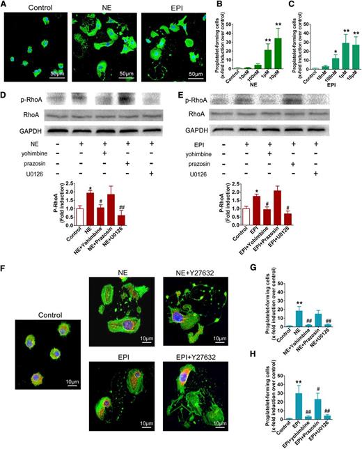 Figure 6. NE and EPI facilitate PPF. (A) Representative photographs of PPF after NE (1 μM) or EPI (1 μM) stimulation. Cytoskeleton actin (green) and the nucleus (blue) were stained. (B-C) Quantification of proplatelet-forming MKs treated with NE or EPI at different concentrations under an inverted microscope. (D-E) Western blot analysis of the expression of the phospho-RhoA in MKs prestimulated with yohimbine, prazosin, or U0126 for 20 minutes followed by NE or EPI treatment of 30 minutes. (F) Morphology exhibition of MKs treated with 10 μM of the ROCK inhibitor Y27632 for 20 minutes before stimulation with NE or EPI. Cytoskeleton actin (green), tubulin (red), and the nucleus (blue) were stained. (G-H) The counts of proplatelet-forming MKs exposed to 10 μM prazosin, 10 μM yohimbine, or 10 μM U0126 prior to NE or EPI stimulation. *P < .05, **P < .01, vs control; #P < .05, ##P < .01, vs NE or EPI treatment group.