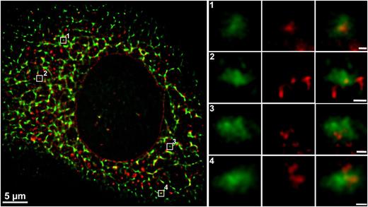Figure 1. Interaction of PDI and VWF shown by 2-color STORM super-resolution microscopy. Endogenous VWF and PDI in HUVECs were detected by indirect immunofluorescence employing rabbit anti-VWF plus goat anti-rabbit Alexa Fluor 488 (shown in green) and mouse anti-PDI plus goat anti-mouse Alexa Fluor 647 (shown in red), respectively. Colocalization is shown in yellow. Locations of magnified ROIs in the cell (left) are indicated by white squares and numbers. STORM data sets were acquired on a Nikon N-STORM microscope with an Apo TIRF 100× oil immersion objective (NA 1.49), a back-illuminated EMCCD camera, and a quadband filter composed of a quadline beam splitter and a quadline emission filter. For excitation of Alexa Fluor 647 and 488, a 647-nm continuous wave fiber laser, and the 488-nm line of an argon gas laser were used. For multicolor imaging, the lasers were switched on and off alternately, controlled by an acousto-optic tunable filter. The integration time of the EMCCD camera was set to 16 ms per frame, with an EM gain of 300. Super-resolution images were reconstructed from a series of 12 500 images per channel, using the N-STORM analysis module v. 3.3.1.15801 of NIS Elements AR v. 4.20 with overlapping peak detection enabled. Scale bar in the left cell image represents 5 µm; in magnified images, 100 nm.