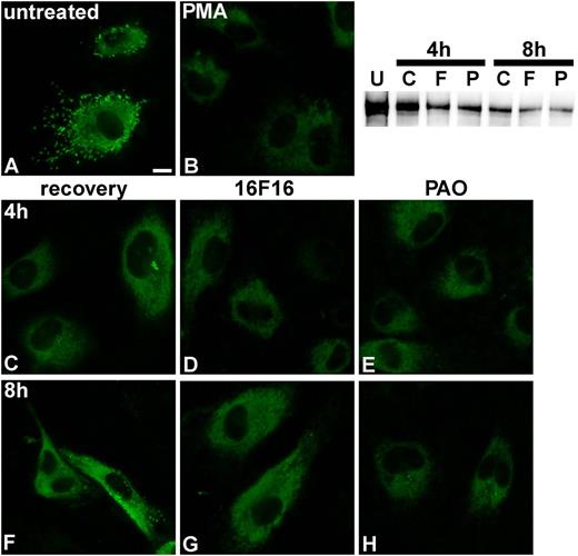 Figure 4. Influence of PDI inhibitors on VWF processing. HUVECs (A) were incubated with 80 nM PMA for 25 min at 37°C/5% CO2 to induce VWF release from WPBs (B). Cells were washed 5-fold with phosphate-buffered saline, and either medium (C,F) or medium containing 2 µM 16F16 (D,G) or 100 nM PAO (E,H) was added. After 4 h (C-E) and 8 h (F-H), VWF was detected by immunofluorescence. Images that combine all planes of the cells were imaged, using the quick-full-focus function of the BZ9000 fluorescence microscope (Keyence) equipped with a CFI Plan Apo λ 60× H oil objective (Nikon). Representative images of 1 of 5 independent experiments are shown. Scale bar represents 10 µm. The western blot shows VWF dimers in HUVEC lysates before PMA treatment (U) and after 4 and 8 hours of recovery without PDI inhibitors (C) or in the presence of 16F16 (F) or PAO (P).