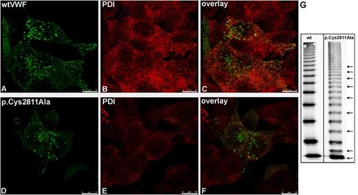 Figure 7. Intracellular localization and multimer pattern of mutant p.Cys2811Ala. wtVWF (A) and VWF mutant p.Cys2811Ala (D) were transiently expressed in HEK293 cells. Forty-eight hours after transfection, cells were fixed and VWF proteins (A,D) and PDI (B,E) were detected by indirect immunofluorescence employing rabbit anti-VWF and mouse anti-PDI antibodies, respectively. Z-stacks were recorded with a confocal microscope using an HC PL APO CS2 63.0 × 1.40 oil ultraviolet objective and the following settings: image size of 512 × 512 pixels, laser power of the 543 and 488 lasers was set to 9% and 20%, respectively. Overlays are shown in (C) and (F). Three-dimensional reconstruction was performed using the LAS software (Leica). Scale bars represent 10 µm. For movies of the rotating complete 3-dimensional reconstruction, please refer to supplemental Videos 1 and 2. (G) Multimer analysis of recombinant wtVWF and mutant p.Cys2811Ala was performed by sodium dodecyl sulfate–agarose gel electrophoresis and immunoblotting onto a nitrocellulose membrane with luminescent visualization. The figure is composed of one gel. The black line indicates deleted lanes with mutants not relevant for this study. Additional bands in mutant p.Cys2811Ala resulting from odd-numbered multimers are indicated by black arrows. For resolution of the monomer and dimer band, please refer to supplemental Figure 6.