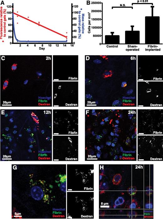 Figure 1. Endocytic degradation of extravascular fibrin in vivo. (A) Fluorescent fibrin gels placed in subcutaneous space undergo degradation. Alexa Fluor 488–labeled fibrin gels were placed in the dermis of mice. The gels were extracted at the indicated time points, and gel weight (blue circles) and total fluorescence (red diamonds) were determined. Data are expressed as percent residual weight and residual fluorescence, as compared with control gels stored for the identical time period in the dark at 37°C in PBS with sodium azide. Triplicate readings for each sample were made and divided by the mean reading of the control gels to yield percent remaining fluorescence. (B) Fibrin implantation causes cell recruitment. Total cell number in control (left bar), sham-operated (middle bar), and fibrin-implanted (right bar) mice at 24 hours, as determined by the counting of nuclei in serial z-stacks from the implantation zone. Data are shown as mean ± standard deviation. N = 7 mice for control, 7 for sham operated, and 12 for fibrin-implanted mice. Significance was determined by 1-way ANOVA. (C-G) Fibrin implanted to subcutaneous space undergoes cellular endocytosis. (C-F) Representative images of mouse dermis 2, 6, 12, and 24 hours postinjection show progressive accumulation of cells that present with fluorescently labeled fibrin (green, white in top insets) in perinuclear vesicles sometimes colocalizing with the Alexa Fluor 647 dextran lysosomal marker (red, white in bottom insets). (G) High magnification of a single fibrin-internalizing cell showing the colocalization of fibrin (green, white in top inset) and dextran (red, white in bottom inset) in perinuclear vesicles (yellow), indicative of lysosomal routing of endocytosed fibrin. (H) Fibrin uptake (green) by cells 24 hours after fibrin implantation in Gt(ROSA)26Sortm4 (ACTB-tdTomato,-EGFP)Luo+/0 transgenic mice expressing plasma membrane–localized tomato fluorescent protein (red). Cross hairs mark a cell with multiple fibrin-containing vesicles completely circumscribed by plasma membrane. N.S., not significant.