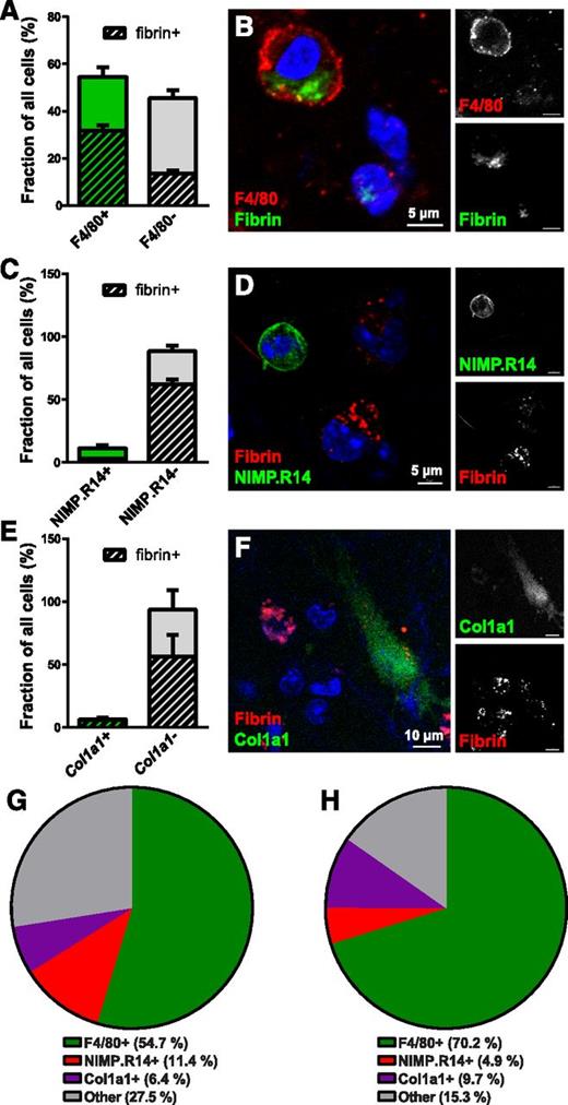 Figure 2. Macrophages are the principal cells mediating extravascular fibrin endocytosis in vivo. (A-B) Endocytic fibrin uptake by F4/80-positive cells. (A) Percentage F4/80-positive (green bar) and F4/80-negative (gray bar) cells in fibrin implantation zones. Crosshatched bars embedded within green and gray bars show fraction of, respectively, F4/80-positive and F4/80-negative cells that endocytose fibrin. Whole-mount immunostaining was performed 24 hours after fibrin implantation. Data were generated from serial analysis of confocal z-stacks from 3 mice as described in “Materials and methods.” Error bars indicate standard deviation. (B) Example of a F4/80-positive (red, white in top right panel) fibrin-internalizing (green, white in bottom left panel) cell. (C-D) Endocytic fibrin-uptake by NIMP.R14-positive cells. (C) Percentage of NIMP.R14-positive (green bar) and NIMP.R14-negative (gray bar) cells in fibrin implantation zones. Crosshatched bars embedded in green and gray bars show fraction of, respectively, NIMP.R14-positive and NIMP.R14-negative cells that endocytose fibrin. Whole-mount immunostaining was performed 24 hours after subcutaneous fibrin implantation. Data were generated as in panel A from 3 mice. (D) Example of a NIMP.R14-positive (green, white in top right panel), fibrin-negative cell, and examples of NIMP.R14-negative fibrin-positive (red, white in top panel) cells. (E-F) Endocytic fibrin-uptake by Col1a1-GFP–positive cells. Percentage of GFP-positive (green bar) and GFP-negative (gray bar) cells in implantation zones from fibrin-implanted Col1a1-GFP+/0 transgenic mice. Crosshatched bars embedded in green and gray bars show fraction of, respectively, GFP-positive and GFP-negative cells that endocytose fibrin. Data were generated as in panel A from 3 mice. (F) Example of an GFP-positive (green, white in top right panel) fibrin-internalizing (red, white in bottom left panel) cell. (G-H) Pie charts showing the constitution of all cells (G) and fibrin-internalizing cells (H) in the fibrin implantation zone.