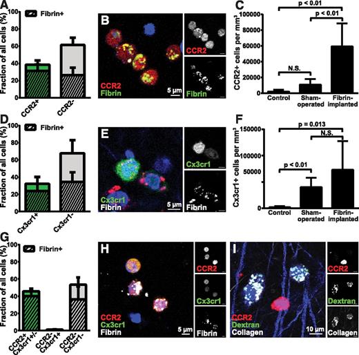 Figure 3. CCR2-positive and CCR2-CX3CR1 double-positive macrophages accumulate in fibrin deposits and mediate endocytic fibrin uptake. (A) Endocytic fibrin uptake by CCR2-positive cells. Percentage CCR2-positive (green bar) and CCR2-negative (gray bar) cells 24 hours after implantation of fibrin into CCR2+/RFP transgenic mice. Crosshatched bars embedded within green and gray bars show fraction of, respectively, CCR2-positive and CCR2-negative cells that endocytose fibrin. Data were generated from serial analysis of confocal z-stacks from 5 mice as described in “Materials and methods.” Error bars indicate standard deviation. (B) Examples of CCR2-positive (red, white in top right panel) cells with endocytosed fibrin 24 hours after fibrin implantation. (C) CCR2-positive cells accumulate in fibrin implantation zones. Total number of CCR2-positive cells in control (left bar), sham-operated (middle bar), or fibrin-implanted (right bar) dermis at 24 hours, as determined by the counting of cells in 4 serial z-stacks from the implantation zone. Data are shown as mean ± standard deviation and were generated by analysis of 4 control, 4 sham-operated, and 5 fibrin-implanted mice. Significance was determined by 1-way ANOVA. (D) Endocytic fibrin uptake by CX3CR1-positive cells. Percentage CX3CR1-positive (green bar) and CX3CR1-negative (gray bar) cells 24 hours after implantation of fibrin into Cx3cr1+/GFP transgenic mice. Crosshatched bars embedded within green and gray bars show fraction of, respectively, CX3CR1-positive and CX3CR1-negative cells that endocytose fibrin. Data were generated from serial analysis of confocal z-stacks from 5 mice as described in “Materials and methods.” Error bars indicate standard deviation. (E) Examples of a CX3CR1-positive cell (green, white in top right panel) with endocytosed fibrin (red, white in bottom right corner) 24 hours after fibrin implantation. (F) CX3CR1-positive cells accumulate in fibrin implantation zones. Total number of CX3CR1-positive cells in control (left bar), sham-operated (middle bar), or fibrin-implanted (right bar) dermis at 24 hours, as determined by the counting of cells in 4 serial z-stacks from the implantation zone. Data are shown as mean ± standard deviation and were generated by analysis of 5 control, 8 sham-operated, and 10 fibrin implanted mice. Significance was determined by 1-way ANOVA. (G) CCR2 single-positive and CCR2, CX3CR1 double-positive cells constitute the majority of fibrin-uptaking cells. Percentage of CCR2 single-positive and CCR2, CX3CR1 double-positive (left bar) and CX3CR1-negative (middle bar), and CCR2, CX3CR1 double-negative cells 24 hours after implantation of fibrin into Cx3cr1+/GFP;CCR2+/RFP bitransgenic mice. Crosshatched bars embedded in bars show fraction of, respectively, CCR2-positive and CCR2-negative cells that endocytose fibrin. A total of 32% of the cells in the left bar are CCR2 single positive and 68% are CCR2, CX3CR1 double positive. Data were generated from serial analysis of confocal z-stacks from 4 mice as described in “Materials and methods.” Error bars indicate standard deviation. (H) Examples of CCR2, CX3CR1 double-positive cells (orange/yellow, white top right and middle panels) with endocytosed fibrin (white) 24 hours after fibrin implantation. (I) CCR2-positive cells do not engage in endocytic collagen degradation. Representative example of injection field from Cx3cr1+/GFP;CCR2+/RFP bitransgenic mice 24 hours after injection with fluorescently labeled fibrillar collagen. Collagen-uptaking (white) CCR2-negative cells and a collagen-negative, CCR2-positive (red, white top right corner) cell are shown.