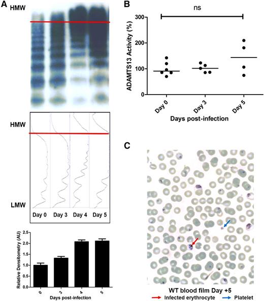 Figure 3. Severe P berghei malaria influences plasma VWF multimer composition. (A) Plasma VWF multimer distribution during the course of malaria infection was assessed by nonreducing agarose gel electrophoresis. Typical multimer gels from example mice are presented. From day +3 following P berghei infection, abnormal UL-VWF multimers were consistently observed in murine plasma. Densitometric scanning of multimer gels was also performed, with individual panels corresponding to each lane. The horizontal axis is optical density. Abnormal UL-VWF multimers are present from day +3 through day +5 (highlighted by bands beyond the arbitrary red line) that are not present before P berghei infection. (B) Plasma ADAMTS13 activity levels were measured by FRETS-VWF73 proteolysis assay. All assays were performed in triplicate, and results represent the mean values. NS, not significant. (C) Typical Giemsa-stained peripheral blood film from a WT C57BL/6J mouse at day +5 following P berghei infection. Infected erythrocytes and thrombocytopenia are evident, but there are no significant features of microangiopathic hemolytic anemia. AU, arbitrary unit; HMW, high molecular weight; LMW, low molecular weight.