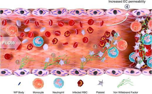Figure 6. Schematic diagram illustrating the proposed mechanisms through which VWF is involved in malaria pathogenesis. EC activation and release of WP body contents constitute common early features in both human and murine malaria. This results in the secretion in the release of UL-VWF multimers into the plasma (1) and a marked increase in plasma VWF levels. VWF may influence malaria pathogenesis through several different mechanisms. First, UL-VWF strings on the surface of activated EC recruit and sequester platelets within the microvasculature (2). These tethered platelets cause further EC activation, and thus more WP body secretion. In addition, the platelet-decorated VWF may be important in modulating further sequestration by recruiting both malaria-infected erythrocytes and by binding to granulocytes and activated monocytes respectively (3). The VWF-mediated sequestration of platelets, infected erythrocytes, and leukocytes leads to further enhanced EC activation. During the later stages of CM pathogenesis, VWF may be important in regulating EC permeability, BBB permeability, and leukocyte extravasation (4). Finally, given that platelets play a critical role in the development of microvasculature occlusion, we postulate that VWF may also be important in this context (5).