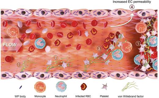 This demonstrates the sequential role of VWF in the process of central nervous system (CNS) malaria. Endothelial cells are activated and release VWF from the Weibel Palade bodies into circulating blood, platelets adhere, parasite-infected red blood cells (RBCs) are recruited, and VWF induces increased endothelial cell permeability and leads to CNS thrombosis. EC, endothelial cell; WP, Weibel Palade. The figure has been adapted from Figure 6 in the article by O’Regan et al that begins on page 1192.