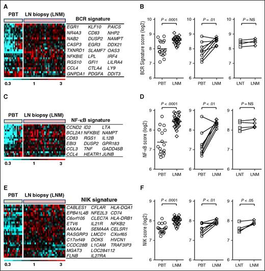 Figure 2. Activation of BCR and NF-κB signaling and tumor proliferation in LN-resident cells. (A) Twenty-seven genes comprising a previously validated BCR gene signature are depicted in a heat map. Gene expression data were median-centered and scaled as indicated. Each column represents a patient’s sample; each row represents a gene. Genes are vertically arranged in the corresponding table, following the same order as in the heat map. (B) The BCR signature score was computed by averaging the mRNA expression level of all signature genes. Signature scores between PBT and LNM groups were compared using unpaired Student t test (left panel). BCR scores in matched MCL PBT/LNM (n = 8) and LNT/LNM (n = 4) samples were compared using paired Student t test (right panels). Matched samples were concomitantly collected from the same patient and are connected with a line. (C) Heat map of 18 genes representing the canonical NF-κB pathway (NF-κB signature) generated after a supervised clustering of the samples. Patients’ samples and gene names are arranged in columns and rows, respectively. Genes are vertically arranged in the corresponding table, following the same order as in the heat map. (D) The NF-κB signature scores of MCL PBT, LNM, and LNT were compared as in (B). (E) Heat map of 28 genes representing the alternative NF-κB pathway (NIK signature) generated after a supervised clustering of the samples. Patients’ samples and gene names are arranged in columns and rows, respectively. Genes are vertically arranged in the corresponding table, following the same order as in the heat map. (F) The NIK signature scores of MCL PBT, LNM, and LNT were compared as in (B). LNM, whole lymph node biopsy.