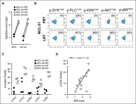 Figure 3. Activation of signal transduction components of the BCR and downstream pathways. Phosphorylation of SYK, PLCγ, ERK, AKT, and p65 was assessed by flow cytometry in CD5+/CD19+ MCL cells from the PB and LN. (A) Comparison of the BCR and NF-κB signature scores between PBT and LNT samples concomitantly isolated from 2 patients providing matched cell samples. (B) Flow plots of PB and LN samples from a representative patient are shown. (C) Summary of phosphoprotein analysis (tested in duplicate) for matched PB and LN samples from the 2 patients shown in (A). (D) Pearson correlation r was used to measure the relationship of the percent tumor cells with detectable p-SYK and the corresponding BCR signature score in MCL-PBT (n = 14).