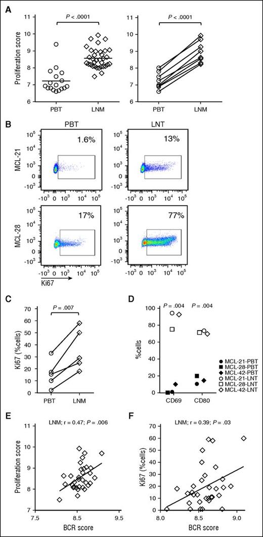 Figure 4. The LN microenvironment promotes tumor activation and proliferation. (A) The MCL-proliferation score was compared between PBT and LNM groups using unpaired Student t test (left panel). MCL-proliferation scores in matched MCL PBT/LNM (n = 8) samples were compared using paired Student t test (right panel). (B) Representative PBT and LNT samples from 2 patients with MCL were tested for Ki67 using flow cytometry. (C) Comparison of Ki67-positive cells between PBT and LNM (n = 5) samples concomitantly collected from the same patient. (D) The activation markers CD69 and CD80 were measured using flow cytometry in CD5+/CD19+-gated cells of matched PBT and LNT from 3 patients with MCL. Pearson correlations of the (E) proliferation score in LN biopsies (LNM, n = 34) and (F) the percent Ki67-positive cells in LNM (n = 32) quantified by immunohistochemistry, with the corresponding BCR signature score.