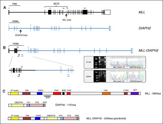 Figure 4. Identification of the novel fusion gene MLL-DIAPH2 in an AML sample with t(X;11)(q13;q23). (A) Structure of the MLL (KMT2A) and DIAPH2 genes indicating the DNA breakpoint regions in MLL intron 10 and DIAPH2 intron 4 in this patient with a t(X;11)(q13;q23). (B) Structure of the MLL-DIAPH2 fusion gene verified using PCR amplification and Sanger sequencing of leukemic DNA using primers 1 and 2 (p1 and p2) and cDNA using primers 3 and 4 (p3 and p4). Gel electrophoresis and Sanger sequencing of the PCR product from each experiment are shown delineating translocation breakpoint in DNA sequence (intron 10 of MLL and intron 4 of DIAPH2), and in cDNA (exon 10 of MLL and exon 5 of DIAPH2). (C) Protein structure of MLL, DIAPH2, and (predicted) MLL-DIAPH2 fusion. AT, adenine-thymine hook DNA-binding; BCR, breakpoint cluster region; bkpt, breakpoint; BRD, bromodomain; CXXC, cysteine-X-X-cysteine; DAD, diaphanous autoregulatory domain; FH1-3, formin homology 1-3; FYRC, phenylalanine (F)/tyrosine (Y)-rich C-terminal; GBD, rho GTPase-binding; PHD, plant homeodomain; SET, Su(var)3-9, Enhancer-of-zeste and Trithorax.