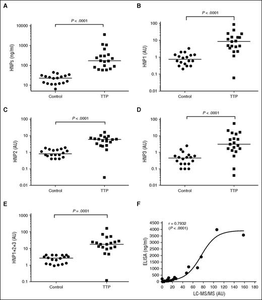 Figure 5. Plasma levels of HNP1-3 and subtypes (HNP1, HNP2, and HNP3) in patients with acquired autoimmune TTP. (A) Plasma levels of HNP1-3 in patients with acquired autoimmune TTP and healthy controls as determined by ELISA. (B-E) The plasma levels of HNP1, HNP2, HNP3, and total HNP1+2+3, respectively, in patients with acquired autoimmune TTP and healthy controls as determined by LC-MS/MS. The relative abundance of HNP1, HNP2, and HNP3 in TTP patients was determined by comparing with that in the mean value of each HNP in normal human plasma (defined as having 1 AU/mL). (F) The Spearman rank correction coefficient (ρ = 0.7932) between LC-MS/MS and ELISA for measurement of total plasma levels of HNP1-3 using GraphPad Prism 6. P values <.05 and .01 are considered to be statistically significant and highly significant.