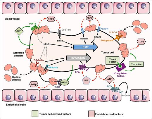 Figure 1. Role of platelets in the control of EMT and invasion of CTCs. CTC-mediated platelet activation depends on platelet/tumor cell interaction involving the nonrestricted list of platelet adhesive molecule P-selectin, GPIIb-IIIa (αIIbβ3 integrin),41 and interaction of C-type lectin-like receptor (CLEC)-2 with tumor-derived podoplanin.45 Tumor cells secrete ADP that interacts with P2Y12, high-mobility group box1 protein 1 (HMGB1) that interacts with TLR-4 and express the tissue factor that activates the coagulation factors (VIIa/Xa) leading to thrombin production. All these factors mediate platelet activation and secretion of TGF-b.30,32,49 Then, TGF-β activates the TGF-β–RI/II–Smad signaling pathway that combines with an unidentified platelet adhesion-dependent mechanism leading to NF-κB activation, which induces EMT on CTCs.24 Released PDGF can activate Notch1 and STAT1 signaling pathways, inducing and/or maintaining EMT on CTCs.25,26 Direct interaction of platelet membranes exposes active P-selectin and GPIIb-IIIa,41 and the secretion of LPA by activated platelets supports CTC invasion39,40 and ATP promotes transendothelial cell migration.37 Figure was generated using the database of images from Servier Medical Art from Servier (http://creativecommons.org/licenses/by/3.0/fr/).
