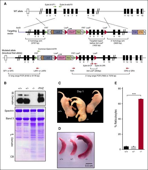 Figure 1. Targeted disruption of dematin gene. (A) Targeting vector. Top panel depicts WT mouse dematin (Epb4.9/Epb49/Dmtn/ AI325486) gene. The exon 5 to 8 region is targeted for deletion and the flanking regions upstream (5.7 kb) and downstream (3.9 kb) that constitute the 5′-homology arm and 3′-homology arm of the targeting vector (middle). Lower panel represents the correctly targeted dematin gene designated as knockout-first allele. (B) Western blotting and Coomassie blue–stained SDS/polyacrylamide gel electrophoresis profile of RBC ghosts from WT (+/+), heterozygous (+/−), dematin FLKO (−/−) mice, and phenylhydrazine-treated WT (PHZ) erythrocytes/reticulocytes ghosts. Western blotting of RBC ghosts was performed using dematin monoclonal antibody C18 against the core domain of dematin (upper). Similar results were obtained using a polyclonal antibody raised against the full-length dematin. The absence of both 48- and 52-kDa isoforms of dematin in the knockout samples was confirmed with no trace of any residual truncated polypeptide in the expanded gels. In the Coomassie blue–stained SDS/polyacrylamide gel electrophoresis (10%) profile (lower), band 3 was used to normalize equal amounts of total protein. The high reticulocyte count in FLKO samples (∼66%) and PHZ-treated WT (∼60%) samples contributed to distinct profile of membrane polypeptides in the homozygous and WT mice. (C) Pups at day 1. Note the paleness of dematin FLKO (−/−) compared with WT (+/+) and heterozygous (+/−) pups. (D) Splenomegaly observed in dematin FLKO mice. (E) Reticulocyte counts in peripheral blood from WT (+/+), heterozygous (+/−), and dematin FLKO (−/−) mice. Reticulocytes were stained by Thiazole orange and counted by flow cytometry. Data were compared by unpaired t test. Mean ± standard deviation (SD): (+/+), n = 3; (+/−), n = 3; (−/−), n = 3. ***P < .0001.