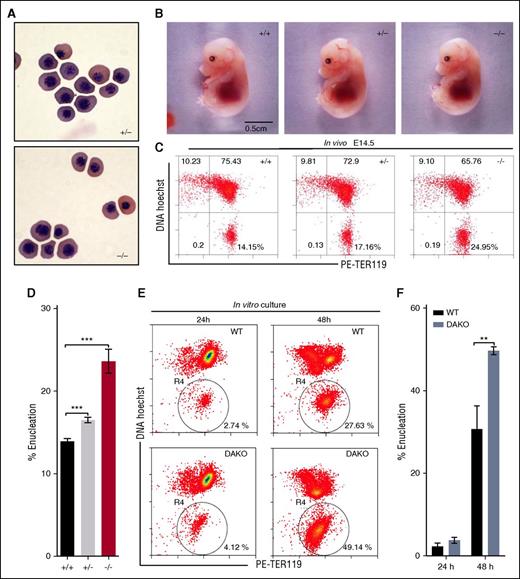 Figure 2. Impact of dematin deficiency on primitive and definitive erythropoiesis. (A) Primitive erythrocytes (Cytospin) from peripheral blood of embryos at E13.5. Wright-Giemsa stain. Shown at ×60 original magnification. (B) Morphology of intact embryos at E14.5 endowed with definitive erythropoiesis. (C) Quantification of mouse fetal erythroblast enucleation in vivo by flow cytometry. The percentage of enucleated cells is indicated in the lower right quadrant. (D) Statistical analysis of erythroblast enucleation in vivo (E14.5). Unpaired t test, mean ± SD, ***P < .001. WT, n = 5; HET, n = 5; FLKO, n = 3. (E) Analysis of mouse fetal liver erythroblast enucleation in vitro. TER119 negative erythroid progenitor cells of E14.5 fetal liver cells from WT and DAKO were isolated and quantified after 24 and 48 hours in culture by flow cytometry using Hoechst 33342 and PE-TER119. Circled R4 region represents the enucleated fraction (HoechstlowTER119high). (F) Percentage of enucleated cells is indicated. Unpaired t test, **P < .01. Mean ± SD; WT, n = 3; DAKO, n = 3.