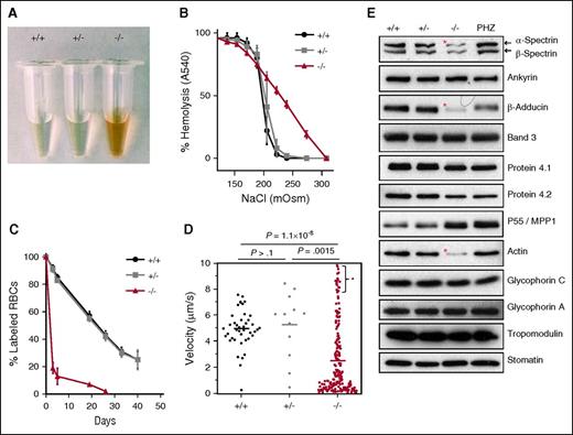 Figure 4. Hematologic characterization. (A) Intravascular hemolysis in dematin FLKO mice. (B) Osmotic fragility analysis. Means ± SD, n = 3 for each genotype. (C) In vivo life span measurement. A dramatic reduction of intact surviving erythrocytes/reticulocytes was observed in FLKO mice. Means ± SD; (+/+), n = 4; (+/−), n = 4; (−/−), n = 5. (D) Dynamic deformability of reticulocytes. Data indicate a marked reduction of dynamic deformability in FLKO reticulocytes. The high velocity fraction (*) presumably represents microcytic vesicles and fragments from labeled reticulocytes. Each dot represents 1 labeled reticulocyte, and the solid bar represents the average derived from 3 animals of each genotype. Data were compared using the Mann-Whitney nonparametric test. (E) Western blot analysis. Membrane proteins from WT (+/+), heterozygous (+/−), dematin FLKO (−/−), and PHZ-treated WT erythrocytes/reticulocytes ghosts. Protein loading was normalized by band 3. Note that the PHZ treatment causes a slight shift in the mobility of adducin and dematin bands (Figure 1B). *Significant protein deficiency.