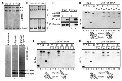 Figure 5. Mechanism of weakened erythrocyte junctional complex. (A) Fairbanks gel electrophoresis (4% acrylamide gel, denaturing conditions) of ghosts. Band 3 was used to normalize protein loading. (B) Spectrin dimer-tetramer equilibrium analysis. Spectrin tetramers were extracted at low ionic strength buffer at 0°C (on ice; upper gel panel) and converted to dimers at 37°C (lower gel panel). Dimer-tetramer content was analyzed by Fairbanks gel electrophoresis under nondenaturing conditions. Note that the spectrin tetramers were dissociated (>95%) into dimers in dematin FLKO (−/−) sample, indicating that dematin loss does to affect spectrin self-association under these conditions. “T” indicates position of spectrin tetramers. “D” indicates position of spectrin dimers. (C) Coimmunoprecipitation of dematin using Flag-β-adducin. HEK293T cells were cotransfected with constructs encoding dematin and Flag-β-adducin (Add2) or empty vector. Immunoprecipitation was performed with anti-Flag agarose beads. Dematin amount in the immune-complex was normalized by western blotting using the anti-dematin polyclonal antibody. (D,F,G) GST pull-down assays. T, Trx tag alone; F, Trx-dematin-rD full length; S, Trx-dematin-rD-S381E mutant; H, Trx-Dematin-headpiece domain; C, Trx-Dematin-core domain-rD; G, GST tag alone; A, GST-β-Adducin; β, GST-β-Spectrin-actin-binding domain1-2; α, GST-α-Spectrin-20-21-EF. Equal loading of GST or GST fusion proteins was confirmed by Coomassie staining. Black dots represent phosphorylation-mimic mutation where serine-381 was changed to glutamic acid (E) in the dematin headpiece domain. Dematin-S381E change promotes dematin headpiece interaction with the core domain. (E) Dematin far-western blotting. Human erythrocyte ghosts were transferred onto nitrocellulose membrane, and blots were incubated with purified human dematin alone or in the presence of purified spectrin. No signal was detected with preimmune serum (lane 1). Anti-dematin polyclonal antibody detected endogenous 48- and 52-kDa polypeptides of dematin (lanes 2 and 3), as well as purified dematin bound to β-spectrin (lane 2). Note that dematin binding to immobilized β-spectrin was eliminated by soluble spectrin (lane 3). Dematin did not bind to α-spectrin under these conditions.