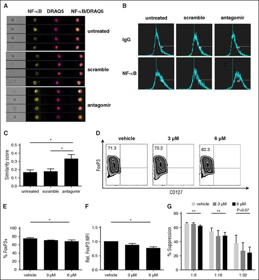 Figure 5. NF-κB activation is essential for human tTreg development and translocating NF-κB to the nucleus after knockdown of miR-146b-5p (n = 3). Cells were left untreated or were incubated with scramble RNA or miR-146b antagomir. Following treatment, cells were stained for CD4, NF-κB, and DRAQ5 and NF-κB nuclear localization determined by imaging flow cytometry. (A) Representative Imagestream images of cultured tTregs showing bright-field images, as well as individual or overlaid images of NF-κB and DRAQ5. (B-C) Representative (B) or summary (C) of similarity score measured by IDEA software quantitating the degree of overlap between NF-κB and DRAQ5 staining. Higher similarity scores indicate increased nuclear localization. For panels D-G, naive peripheral blood tTregs were purified, expanded in vitro, and were treated with either DMSO only or PS1145. (D) Representative example of Foxp3 vs CD127 staining on tTreg (gated on CD4+ cells). (E) Summary of overall %Foxp3+CD127− cells, and (F) level of Foxp3 expression. (G) CFSE assay for suppressive function in tTregs from each group. Values indicate mean ± SEM of these experiments. *P < .05; **P < .01. MFI, mean fluorescence intensity.