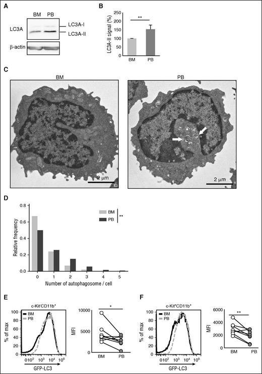 Figure 5. Increased number of autophagosomes and decreased GFP-LC3 expression were observed in PB leukemic cells. (A) Expression of LC3A-I and LC3A-II in BM and PB from GFP-LC3 MLL-ENL leukemic mice. (B) Relative signal intensities of LC3A-II in BM and PB from GFP-LC3 MLL-ENL leukemic mice are shown. Values were normalized to the intensity of LC3A-II/β-actin from BM samples (n = 5, mean ± SD). (C) Representative electron micrograph of c-Kit−CD11b+ cells from BM or PB of MLL-ENL leukemic mice. The grids were observed by a transmission electron microscope (JEM-1400Plus; JEOL Ltd., Tokyo, Japan). Digital images were taken with a CCD camera (VELETA; Olympus Soft Imaging Solutions, Germany). White arrows indicate autophagosomes. (D) Frequency distribution of detectable autophagosomes per cell from electron micrograph analysis. The number of autophagosomes in 100 cells, derived from 2 independent mice, was counted. The P value was calculated with the Wilcoxon rank sum test. Representative histogram and collective data (n = 8) of GFP-LC3 expression in c-Kit−CD11b+ (E) or c-Kit+CD11b+ (F) cells in BM or PB from GFP-LC3 MLL-ENL leukemic mice. Geometric MFIs were plotted. P values were calculated by a Student paired t test. *P < .05; **P < .01. All results are pooled data from at least 3 independent experiments with 1 to 3 animals per experiment.