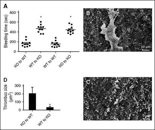 Figure 1. Vessel ECM abnormality contributes to the bleeding diathesis in TSP2 KO mice. (A) Rescue of irradiated WT and KO mice with KO and WT bone marrow cells, respectively, did not alter the bleeding time of the host. In addition, homotypic rescue maintained the original phenotype. Transplant of WT bone marrow to irradiated TSP2 KO mice did not reduce the bleeding time. Circles (●) denote individual mice. (B-C) Representative SEM images of denuded carotid arteries from WT mice receiving TSP2 KO bone marrow (B) and TSP2 KO mice receiving WT bone marrow (C) 10 minutes after wire injury. (D) Quantification of thrombus size by ImageJ revealed a decrease in TSP2 KO arteries. *P < .05