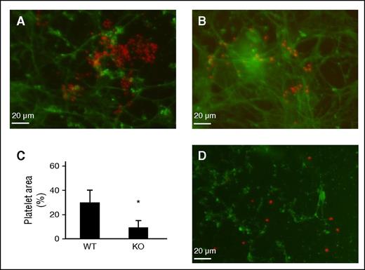 Figure 4. Cell-derived TSP2 KO ECM does not support platelet aggregation. DF-derived ECM was prepared in vitro following decellularization of long-term (7 days) cultures. Mouse platelets were exposed to either WT or TSP2 ECM for 30 minutes. (A-C) Representative images of platelets visualized by rhodamine-phalloidin (red color) on WT (A) or TSP2 KO ECM are shown. Detection of FN (green color) confirms the retention of ECM during the duration of the experiment (Zeiss). (C) Quantification of platelet area by ImageJ showed reduced platelet aggregation on TSP2 KO ECM. n = 5; *P < .05. (D) Incubation of TSP2 KO ECM with 5 μg/mL TSP2 (detected via immunofluorescence, green color) overnight did not appear to increase platelet aggregation on TSP2 KO ECM.