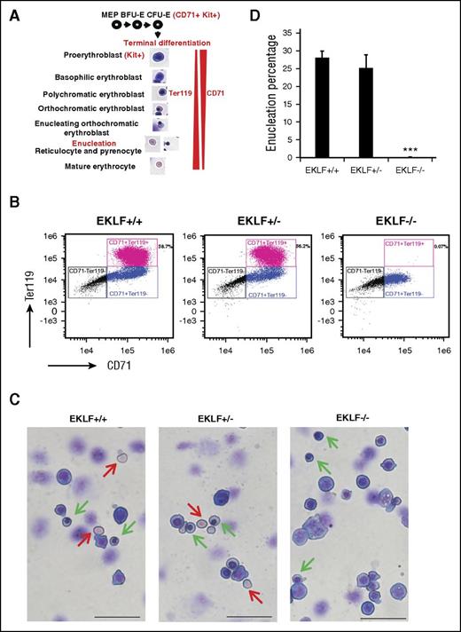 Figure 1. E13.5 Eklf−/− erythroblasts can undergo terminal differentiation reaching the orthochromatic erythroblast stage but do not enucleate. (A) Schematic of the stages of terminal differentiation of E13.5 fetal liver erythroid cells showing the expression profile of Kit, CD71, and Ter119 cell surface markers. During terminal differentiation, erythroid precursors express both CD71 and Ter119. (B) Profile of total intensity of CD71 and Ter119 staining analyzed by imaging flow cytometry of E13.5 Eklf+/+, Eklf+/−, and Eklf−/− fetal liver cells. In Eklf+/+ and Eklf+/− livers, populations of erythroid cells (CD71+) progress from Ter119lo to Ter119+ as they mature. In Eklf−/− livers, the CD71+ cells, although present, lack Ter119 expression. (C) MGG staining of cytospins from E13.5 fetal liver cells show that although Eklf+/+ and +/− fetal livers contain enucleated definitive erythroid cells (red arrows), Eklf−/− fetal livers do not. In addition, Eklf−/− fetal livers contain orthochromatic erythroblast cells (green arrows) similar to Eklf+/+ and Eklf+/− fetal livers. Scale bars correspond to 50 µm length. Original magnification ×40. Slides were processed at the same time. (D) Quantification of percentage of enucleated cells from cytospins of E13.5 Eklf+/+ (n = 34 fields; a total of 1237 cells), Eklf+/− (n = 12 fields; a total of 530 cells), and Eklf−/− (n = 85 fields; a total of 2805 cells) fetal livers. ***P < .001.