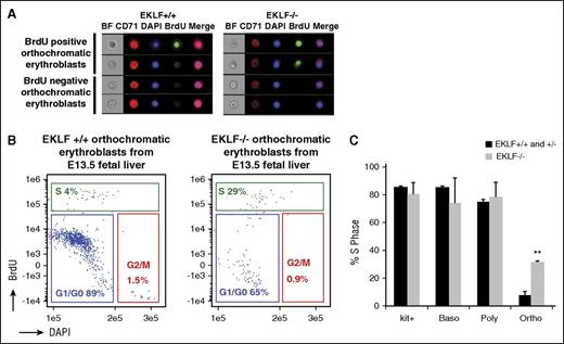 Figure 3. Orthochromatic erythroblasts in the E13.5 Eklf−/− fetal liver have increased proportion of cells in S phase compared with Eklf+/− and Eklf+/+ fetal livers. (A) E13.5 Eklf+/+ and Eklf−/− fetal livers retrieved 1 hour after BrdU injection of pregnant mice were stained for BrdU, CD71, Kit, and DNA (DAPI) and analyzed by imaging flow cytometry. Representative images of Eklf+/+ and Eklf−/− BrdU positive and BrdU negative orthochromatic erythroblasts are shown. See supplemental Figure 3 for images of other maturing erythroblasts. (B) Gating of Eklf+/+ and Eklf−/− BrdU positive (S phase) orthochromatic erythroblasts by imaging flow cytometry is shown. See supplemental Figure 3 for cell cycle analysis of other maturing erythroblasts. (C) Quantitation of percentage of Eklf+/+, Eklf+/−, and Eklf−/− BrdU positive (S phase) cells during progressive stages of erythropoiesis, as analyzed by imaging flow cytometry. Eklf+/+ and Eklf+/− fetal livers (n = 5); Eklf−/− fetal livers (n = 2). **P < .001.