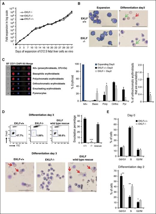 Figure 4. Ex vivo cultures of Eklf−/− erythroblasts recapitulate enucleation and cell cycle defects observed in vivo during terminal differentiation. (A) E12.5 fetal liver definitive erythroid cells were grown in expansion media to derive ESREs. Representative growth curves of Eklf+/+, Eklf−/−, and Eklf+/− fetal liver cultures are shown (from a total of 15). (B) MGG staining of Eklf+/+ and Eklf−/− ESREs at day 0 and at day 3 of terminal differentiation. The red arrow shows enucleated cells present at day 3 of differentiation in Eklf+/+ cultures but absent in Eklf−/− cultures. The green arrow shows representative orthochromatic erythroblasts, which are present in both cultures at day 3 of differentiation. Scale bars correspond to 50 µm length. Original magnification ×40. (C) (Left) Cells were stained with CD71, Kit, and DAPI and analyzed using imaging flow cytometry to identify progressive stages of erythroid differentiation. Representative images of Eklf+/+ kit+ (CFU-Es and proerythroblasts), basophilic, polychromatic, orthochromatic, enucleating orthochromatic erythroblasts and pyrenocytes at day 2 of differentiation obtained by imaging flow cytometry are shown. (Right) Quantification of the progressive stages of erythroid differentiation in ESRE cultures using imaging flow cytometry at day 0 and day 2 of differentiation. Eklf+/+ and +/− (n = 8), Eklf−/− (n = 4). (D) Enucleated cells were measured by flow cytometry using DRAQ5 nuclear stain in Eklf+/+, Eklf−/−, and EKLF wild-type rescue in Eklf−/− cells at day 3 of terminal differentiation. (Left) Flow cytometry gating for the DRAQ5-negative population. (Right) Quantification of biological replicates (n = 3) for all 3 cultures show almost complete absence of enucleation in Eklf−/− erythroid cultures. (Bottom) MGG staining was also performed on Eklf−/− cells with wild-type EKLF rescue at day 3 of terminal differentiation. Red arrows show enucleated cells present at day 3 of differentiation of Eklf+/+ cultures and in Eklf−/− cultures with wild-type EKLF rescue, whereas absent in Eklf−/− cultures. Scale bars correspond to 50 µm length. Original magnification ×40. (E) Cell cycle flow cytometric analysis was performed using ethanol-fixed cells stained with PI before (day 0; top) and after (day 2; bottom) erythroid differentiation in ESRE cultures (n = 3). Eklf−/− cultures show a decrease in percentage of cells at G0/G1 and an increase of cells in S phase in Eklf−/− cultures compared with Eklf+/+ cultures. *P < .05, **P < .01, ***P < .001.