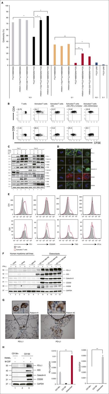 Figure 1. OCs protect MM cells against T-cell–mediated cytotoxicity by upregulating expression of multiple co-inhibitory molecules. (A) OCs and MM-specific CTLs were generated from the same healthy donor. CTLs were cocultured with target cells (KMS28-BM) in the absence or presence of OCs with or without the PD-L1 inhibitor (10 μg/mL)/IDO inhibitors (1-methyl-dl-Trp, 1 mM). After 4 hours, cytotoxicity was evaluated by measuring LDH activity in the supernatants. Shown is mean ± SD of the 3 representative independent experiments. (B) Proliferation of T cells stimulated by anti-CD2/CD3/CD28 beads (T:Bead ratio of 1:1) in the absence or presence of autologous OCs for 5 days was measured with CFSE dilution assay. (C-D) CD14+ monocytes were cocultured with RANKL and M-CSF for 14 days, and OCs were identified by TRAP staining. OCs were also cocultured with IFN-γ (20 IU/mL) for 12 hours. Protein expression in monocytes and OCs were determined by immunoblotting (C) and immunofluorescence (D). (E) T cells stimulated by anti-CD2/CD3/CD28 beads (T:Bead ratio of 1:1). Expression of PD-1, CD200R, Tim-3, and BTLA were examined by flow cytometry. (F) OCs were cultured from PBMCs or BM mononuclear cells from MM patients without CD14 selection. Levels of inhibitory molecules were significantly higher in OCs than in MM cells. (G) IHC analysis of 2 representative BM specimens from MM patients shows PD-L1 expression (brown) on OCs. Original magnification: ×20 (×100 in insets). (H) The expression of PD-L1, IDO, Galectin-9, and CD200 in CD138+ cells, CD138− cells, and OCs from the same patient was determined by immunoblotting and real-time qRT-PCR. *P < .05; **P < .001; by unpaired 2-sided Student t test. GAPDH, glyceraldehyde-3-phosphate dehydrogenase; ICOSL, inducible T-cell co-stimulator ligand; IHC, immunohistochemistry; PB, peripheral blood.