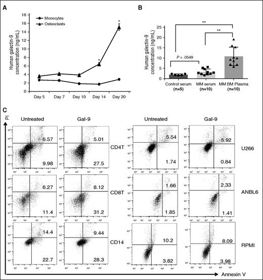 Figure 3. Galectin-9 preferentially induces apoptosis of lymphoid T cells but not myeloid cells and MM cell line cells. (A) CD14+ monocytes were stimulated with RANKL and M-CSF. Supernatant was collected to measured Galectin-9 by ELISA, (B) serum was obtained from 5 healthy donors, and simultaneous serum and BM plasma were obtained from 10 MM patients. Galectin-9 level was determined by ELISA. (C) PBMCs from healthy donors and 3 MM cells were treated with recombinant Galectin-9 (1 μg/mL) for 12 hours, stained with Annexin V/PI, and analyzed by flow cytometry. Bottom right quadrants represent early apoptotic cells (Annexin V-positive only) and top right quadrant the late apoptotic cells (Annexin V- and PI-positive). *P < .05; **P < .001; by unpaired 2-sided Student t test. PI, propidium iodide.