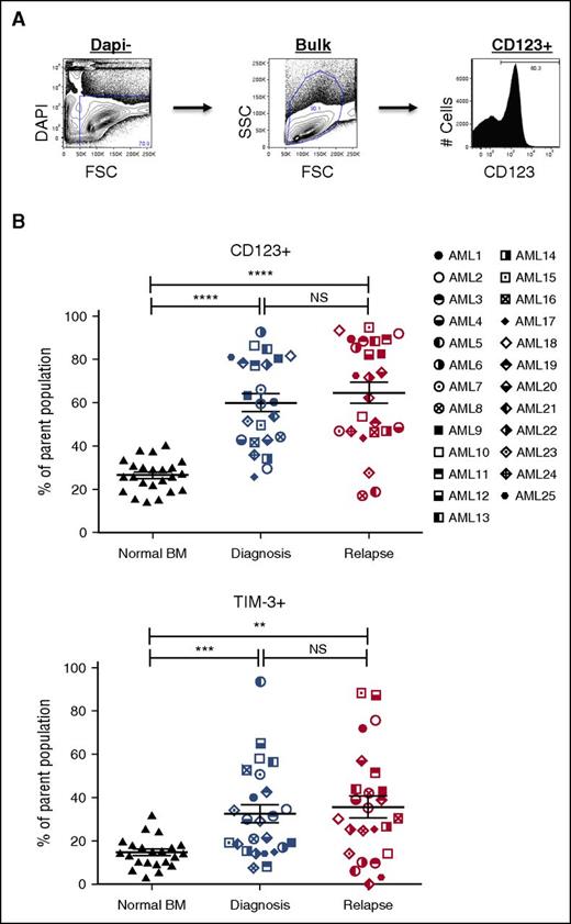 Figure 2. Expression profiles of LSC markers on paired AML diagnosis and relapse samples. (A) A representative example of LSC marker immunophenotyping strategy in AML bulk cells (AML3, diagnosis). The LSC panel included CD32, CD33, CD45RA, CD47, CD96, CD97, CD99, CD123, HLA-DR, IL1RAP, and TIM-3 (top). (B) Frequencies of LSC marker positive populations (CD123+ and TIM-3+) in bulk AML cells at diagnosis (middle) and relapse (right) compared with NBM cells (left) (NBM, n = 22-23; AML, n = 24-25). Mean ± standard error of the mean values are plotted. *P < .05; **P < .01; ***P < .001; ****P < .0001. NS, not significant.