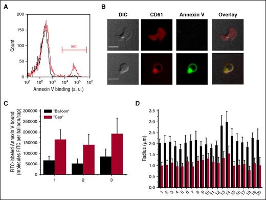 Figure 1. Annexin V distribution on the surface of activated platelets. Platelets (5 × 104 μL−1) were activated with thrombin at 100 nM for 15 minutes, incubated with Annexin V-FITC for 5 minutes, and analyzed using flow cytometry and confocal microscopy. (A) Typical histograms of Annexin V binding to activate platelets in the absence (red line) or presence of EDTA (black line). Region marked M1 indicates the PS-positive platelets. (B) Distribution of Annexin V on the surface of activated platelets. Representative confocal images of DIC, FITC (green) fluorescence of Annexin V, and PE (red) fluorescence of CD61 are shown. Upper row is a typical nonprocoagulant platelet, and lower row is a typical procoagulant “ballooned” platelet. See also supplemental Video 1. Scale bars, 5 μm. (С) Quantitation of Annexin V-FITC binding to the “cap” and to the “balloon” for 3 different donors. The numbers below the bar graphs here and in the remaining figures are donor numbers. (D) Comparison between the sizes of the “caps” and the “balloons” for 20 donors. Results in (C-D) are mean ± standard deviation (SD), determined for at least 50 platelets in each experiment. PE, phycoerythrin.